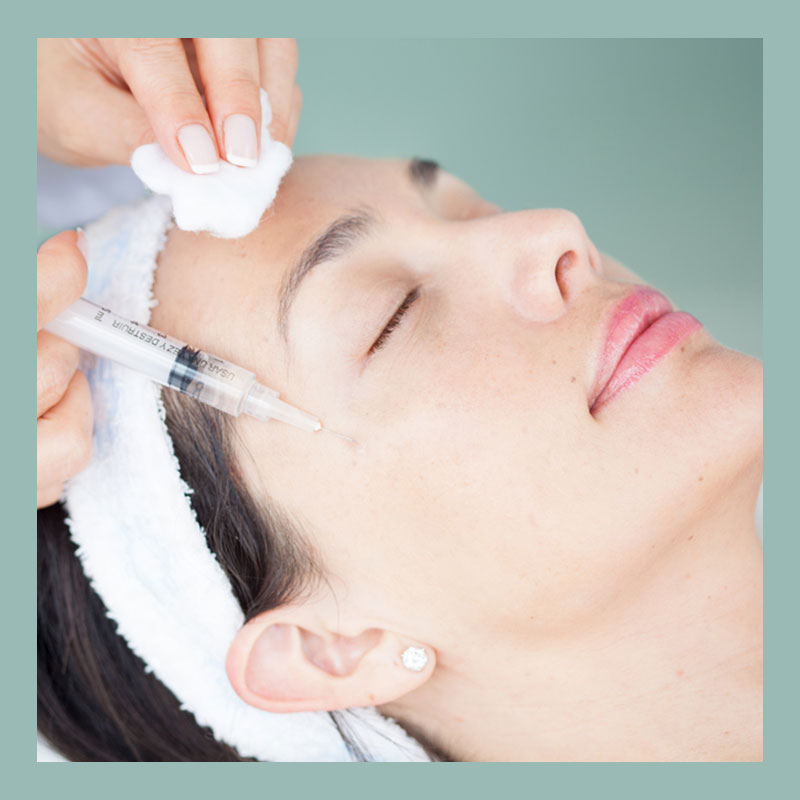 Zabieg mezoterapii igłowej.